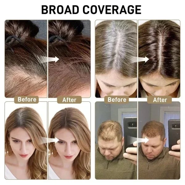 🎁Last Day 70% OFF🎉Buy 2 Get 1 Free🎁Root Cover Up For Effortless Beauty