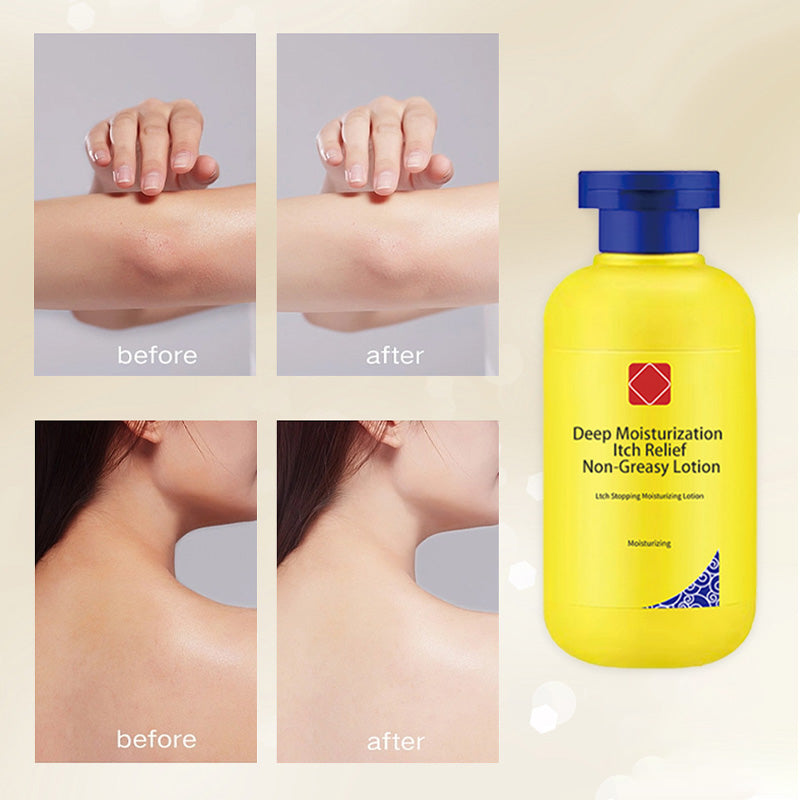 🔥Winter promotion 49% OFF🔥Deep moisturizing itch relief Non-greasy lotion❄️ ☃️