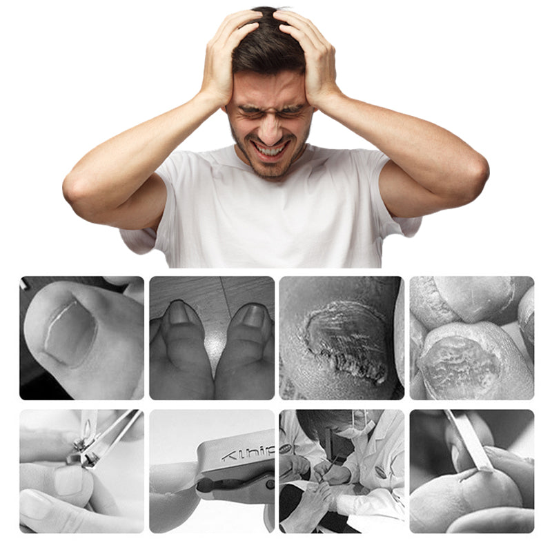 Professional Ingrown Toenail Clipper 7-Piece Set