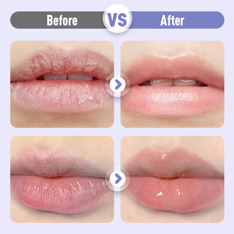 👄Plumping & Anti-Wrinkle Hydrating Lip Serum👄