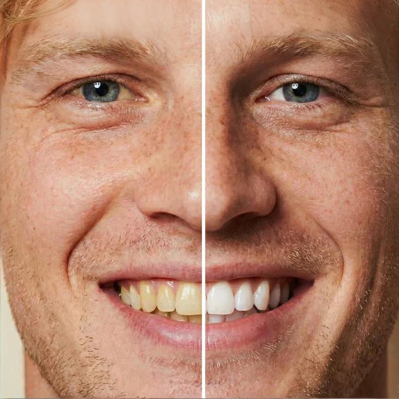 🏆Buy 1 Get 1 Free🧴Instant Whitening Tooth Paint